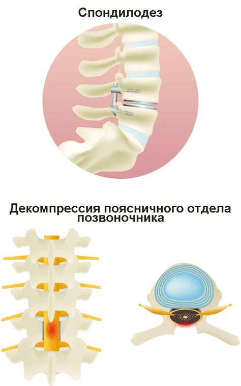 Симптомы дефекта и возможные причины